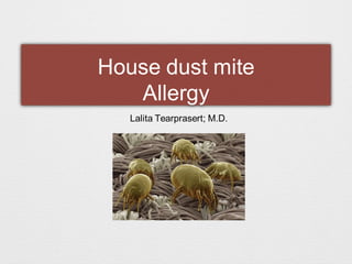 House dust mite
Allergy
Lalita Tearprasert; M.D.
 