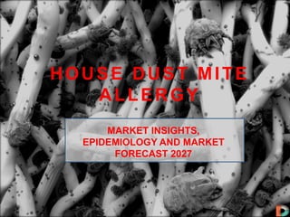 HOUSE DUST MITE
ALLERGY
MARKET INSIGHTS,
EPIDEMIOLOGY AND MARKET
FORECAST 2027
 