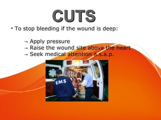 Cuts
• To stop bleeding if the wound is deep:
→ Apply pressure
→ Raise the wound site above the heart
→ Seek medical attention a.s.a.p.
 