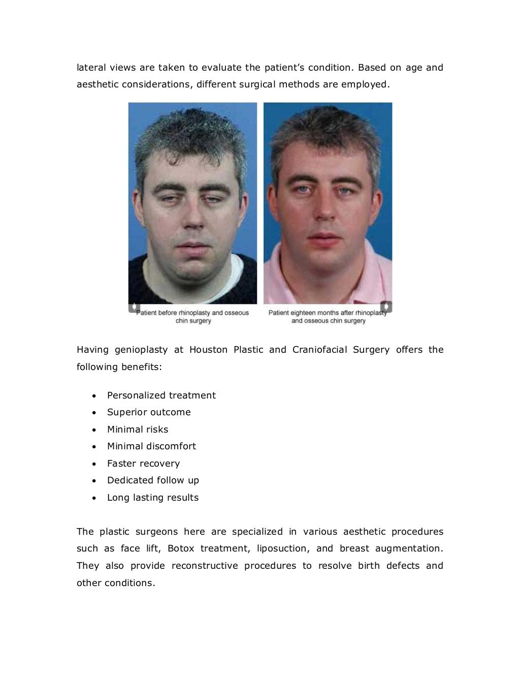 Houston Plastic and Craniofacial Surgery Offering Safe and Effective