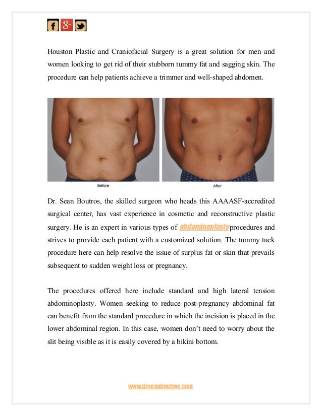 Houston plastic and craniofacial surgery offering effective abdominoplasty
