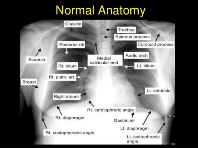 How to read normal x ray
