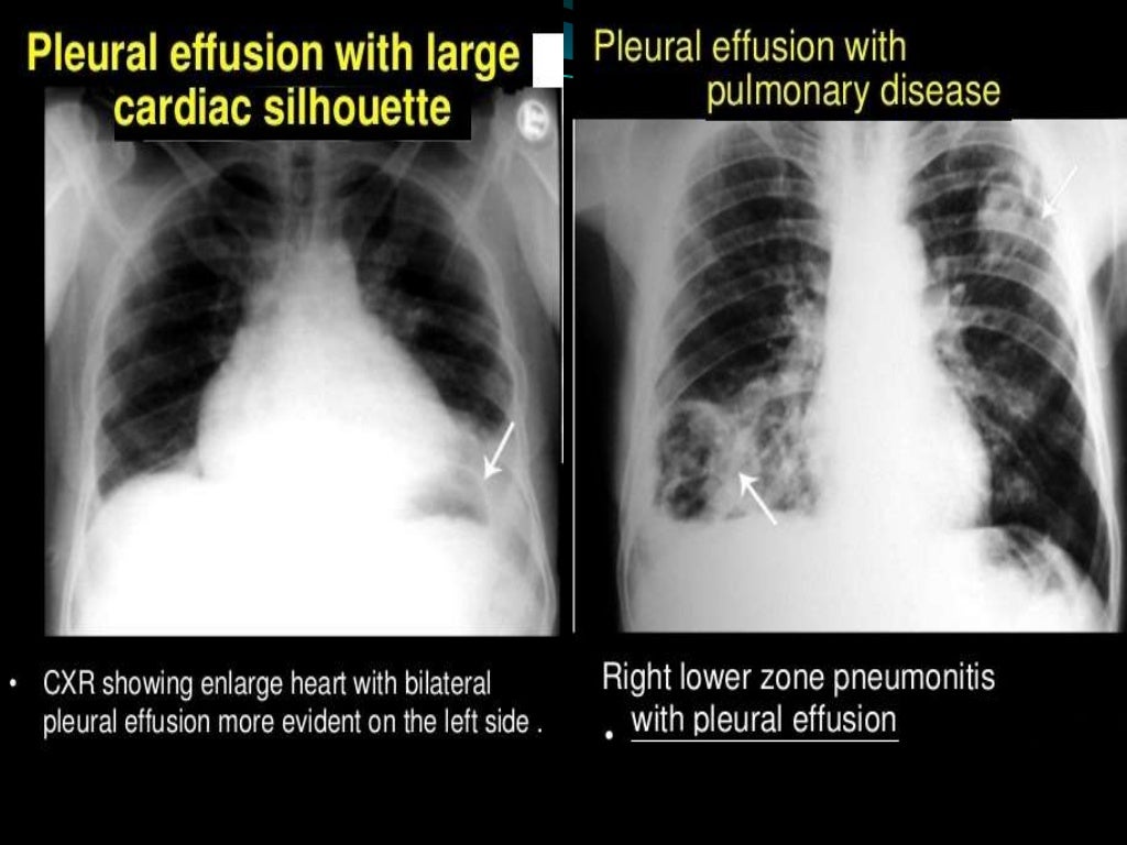 How to read normal x ray