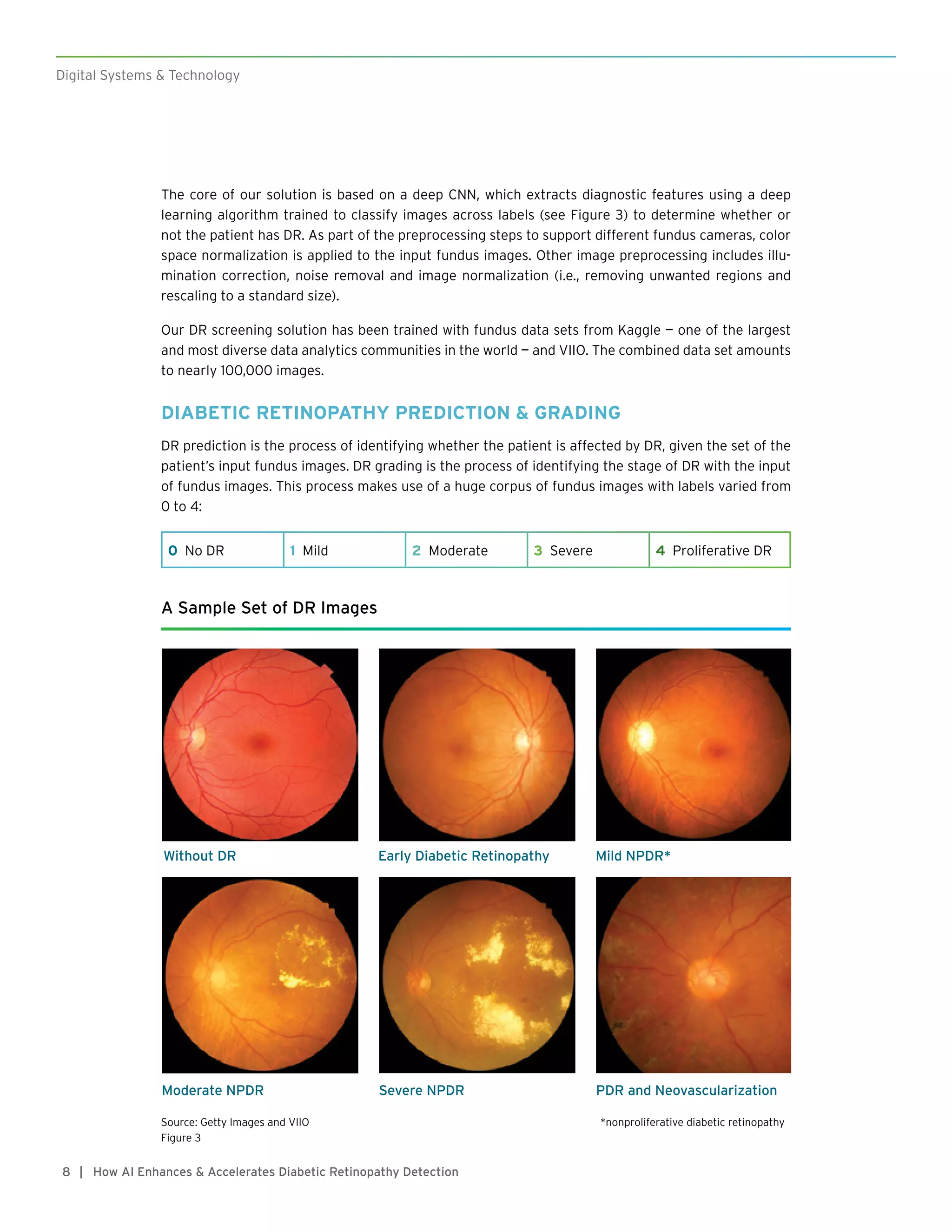 How AI Enhances & Accelerates Diabetic Retinopathy Detection | PDF