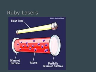 How lasers works | PPT