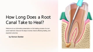 How Long Does a Root
Canal Take to Heal?
Welcome to our informative presentation on the healing process of a root
canal treatment. Discover the steps involved, factors affecting healing, and
expected outcomes.
by Vernon Dentist
 
