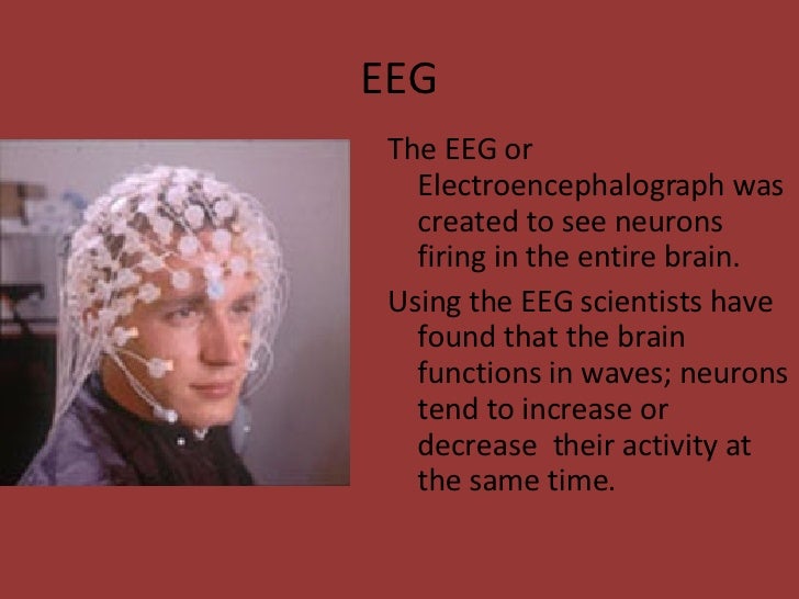 3 Methods Psychologists Use To Study The Brain Study Poster