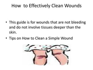 How to Effectively Clean Wounds


• This guide is for wounds that are not bleeding
  and do not involve tissues deeper than the
  skin.
• Tips on How to Clean a Simple Wound
 