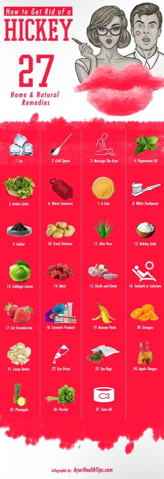 How to Get Rid of a Hickey - Infographic | PDF