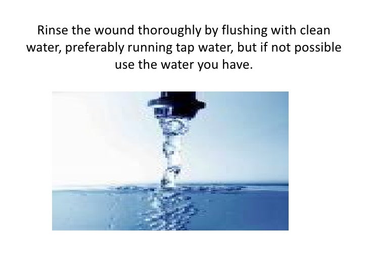 How To Properly Clean A Simple Wound