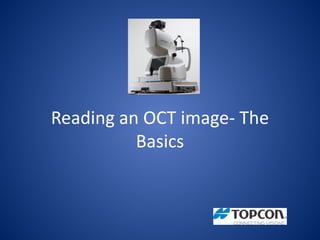 Reading an OCT image- The
Basics
 