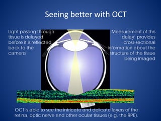 How-to-read-an-OCT-Image.pdf