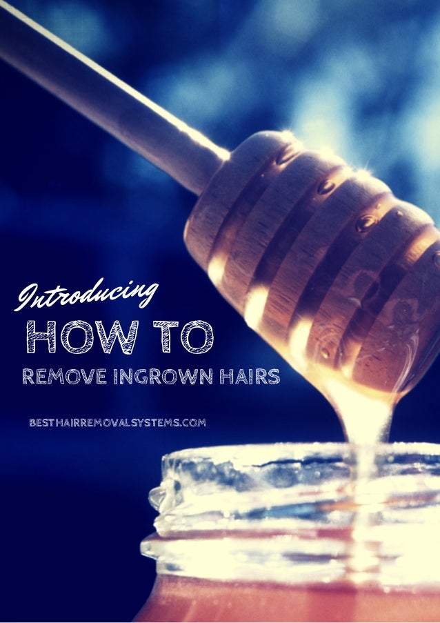 How To Remove Ingrown Hairs