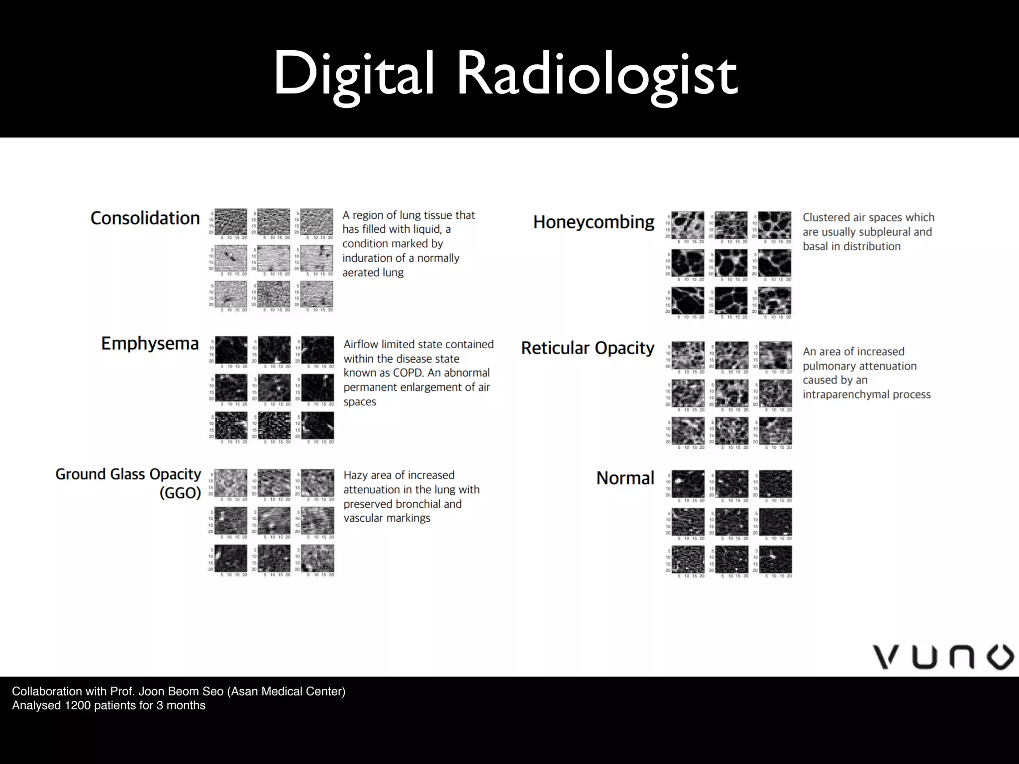 Digital Radiologist
Collaboration with Prof. Joon Beom Seo (Asan Medical Center)
Analysed 1200 patients for 3 months
 