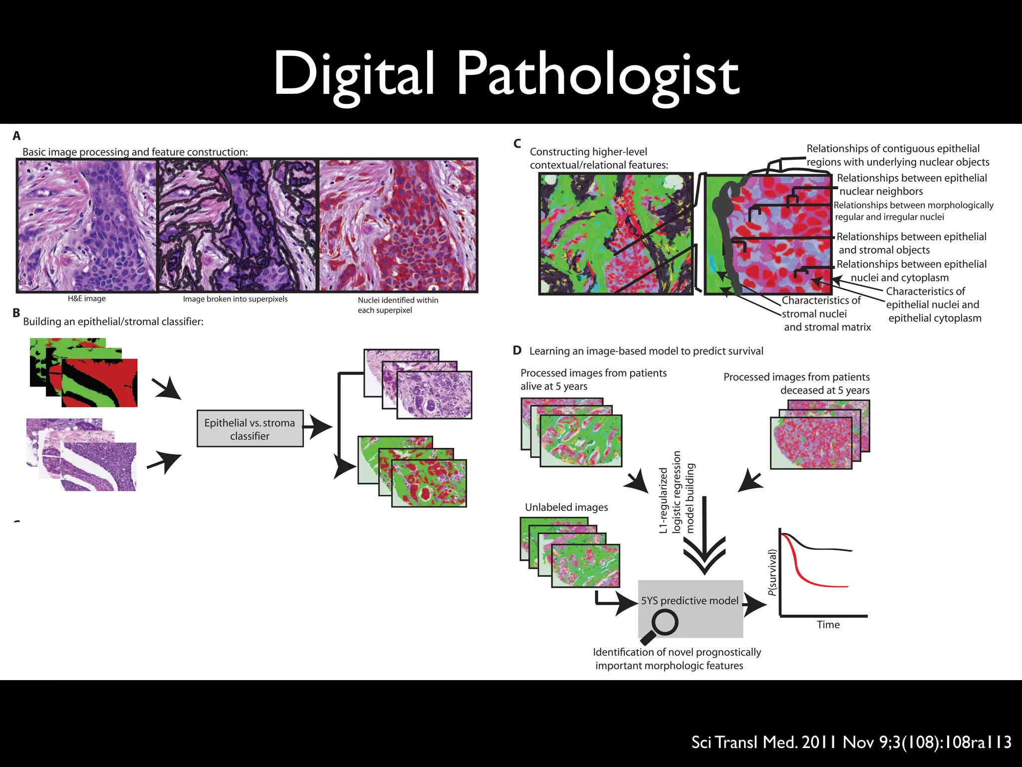 Constructing higher-level
contextual/relational features:
Relationships between epithelial
nuclear neighbors
Relationships between morphologically
regular and irregular nuclei
Relationships between epithelial
and stromal objects
Relationships between epithelial
nuclei and cytoplasm
Characteristics of
stromal nuclei
and stromal matrix
Characteristics of
epithelial nuclei and
epithelial cytoplasm
Building an epithelial/stromal classifier:
Epithelial vs.stroma
classifier
Epithelial vs.stroma
classifier
B
Basic image processing and feature construction:
H&E image Image broken into superpixels Nuclei identified within
each superpixel
A
Relationships of contiguous epithelial
regions with underlying nuclear objects
Learning an image-based model to predict survival
Processed images from patients Processed images from patients
C
D
onNovember17,2011stm.sciencemag.orgwnloadedfrom
TMAs contain 0.6-mm-diameter cores (median
of two cores per case) that represent only a small
sample of the full tumor. We acquired data from
two separate and independent cohorts: Nether-
lands Cancer Institute (NKI; 248 patients) and
Vancouver General Hospital (VGH; 328 patients).
Unlike previous work in cancer morphom-
etry (18–21), our image analysis pipeline was
not limited to a predefined set of morphometric
features selected by pathologists. Rather, C-Path
measures an extensive, quantitative feature set
from the breast cancer epithelium and the stro-
ma (Fig. 1). Our image processing system first
performed an automated, hierarchical scene seg-
mentation that generated thousands of measure-
ments, including both standard morphometric
descriptors of image objects and higher-level
contextual, relational, and global image features.
The pipeline consisted of three stages (Fig. 1, A
to C, and tables S8 and S9). First, we used a set of
processing steps to separate the tissue from the
background, partition the image into small regions
of coherent appearance known as superpixels,
find nuclei within the superpixels, and construct
Constructing higher-level
contextual/relational features:
Relationships between epithelial
nuclear neighbors
Relationships between morphologically
regular and irregular nuclei
Relationships between epithelial
and stromal objects
Relationships between epithelial
nuclei and cytoplasm
Characteristics of
stromal nuclei
and stromal matrix
Characteristics of
epithelial nuclei and
epithelial cytoplasm
Epithelial vs.stroma
classifier
Epithelial vs.stroma
classifier
Relationships of contiguous epithelial
regions with underlying nuclear objects
Learning an image-based model to predict survival
Processed images from patients
alive at 5 years
Processed images from patients
deceased at 5 years
L1-regularized
logisticregression
modelbuilding
5YS predictive model
Unlabeled images
Time
P(survival)
C
D
Identification of novel prognostically
important morphologic features
basic cellular morphologic properties (epithelial reg-
ular nuclei = red; epithelial atypical nuclei = pale blue;
epithelial cytoplasm = purple; stromal matrix = green;
stromal round nuclei = dark green; stromal spindled
nuclei = teal blue; unclassified regions = dark gray;
spindled nuclei in unclassified regions = yellow; round
nuclei in unclassified regions = gray; background =
white). (Left panel) After the classification of each
image object, a rich feature set is constructed. (D)
Learning an image-based model to predict survival.
Processed images from patients alive at 5 years after
surgery and from patients deceased at 5 years after
surgery were used to construct an image-based prog-
nostic model. After construction of the model, it was
applied to a test set of breast cancer images (not
used in model building) to classify patients as high
or low risk of death by 5 years.
www.ScienceTranslationalMedicine.org 9 November 2011 Vol 3 Issue 108 108ra113 2
onNovember17,2011stm.sciencemag.orgDownloadedfrom
Digital Pathologist
Sci Transl Med. 2011 Nov 9;3(108):108ra113
 