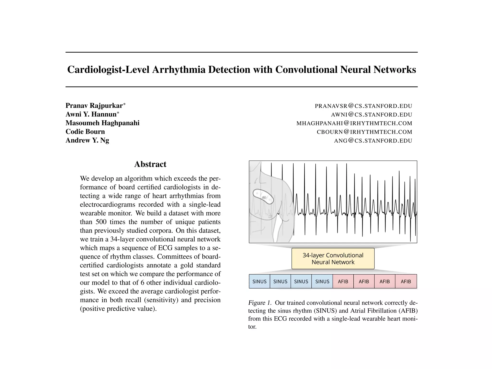 Cardiologist-Level Arrhythmia Detection with Convolutional Neural Networks
Pranav Rajpurkar⇤
PRANAVSR@CS.STANFORD.EDU
Awni Y. Hannun⇤
AWNI@CS.STANFORD.EDU
Masoumeh Haghpanahi MHAGHPANAHI@IRHYTHMTECH.COM
Codie Bourn CBOURN@IRHYTHMTECH.COM
Andrew Y. Ng ANG@CS.STANFORD.EDU
Abstract
We develop an algorithm which exceeds the per-
formance of board certiﬁed cardiologists in de-
tecting a wide range of heart arrhythmias from
electrocardiograms recorded with a single-lead
wearable monitor. We build a dataset with more
than 500 times the number of unique patients
than previously studied corpora. On this dataset,
we train a 34-layer convolutional neural network
which maps a sequence of ECG samples to a se-
quence of rhythm classes. Committees of board-
certiﬁed cardiologists annotate a gold standard
test set on which we compare the performance of
our model to that of 6 other individual cardiolo-
gists. We exceed the average cardiologist perfor-
mance in both recall (sensitivity) and precision
(positive predictive value).
1. Introduction
We develop a model which can diagnose irregular heart
Figure 1. Our trained convolutional neural network correctly de-
tecting the sinus rhythm (SINUS) and Atrial Fibrillation (AFIB)
from this ECG recorded with a single-lead wearable heart moni-
tor.
Arrhythmia detection from ECG recordings is usually per-
formed by expert technicians and cardiologists given the
1707.01836v1[cs.CV]6Jul2017
 