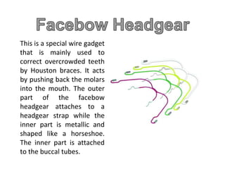 This is a special wire gadget
that is mainly used to
correct overcrowded teeth
by Houston braces. It acts
by pushing back the molars
into the mouth. The outer
part of the facebow
headgear attaches to a
headgear strap while the
inner part is metallic and
shaped like a horseshoe.
The inner part is attached
to the buccal tubes.
 