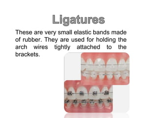 These are very small elastic bands made
of rubber. They are used for holding the
arch wires tightly attached to the
brackets.
 