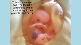 How babies are born edit.pdf