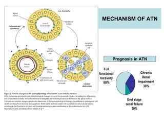 How Best To Prevent & Manage Acute Renal failure | PPT