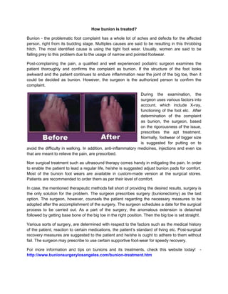 How bunion is treated?
Bunion - the problematic foot complaint has a whole lot of aches and defects for the affected
person, right from its budding stage. Multiples causes are said to be resulting in this throbbing
hitch. The most identified cause is using the tight foot wear. Usually, women are said to be
falling prey to this problem due to the usage of narrow and pointed footwear.
Post-complaining the pain, a qualified and well experienced podiatric surgeon examines the
patient thoroughly and confirms the complaint as bunion. If the structure of the foot looks
awkward and the patient continues to endure inflammation near the joint of the big toe, then it
could be decided as bunion. However, the surgeon is the authorized person to confirm the
complaint.
During the examination, the
surgeon uses various factors into
account, which include X-ray,
functioning of the foot etc. After
determination of the complaint
as bunion, the surgeon, based
on the rigorousness of the issue,
prescribes the apt treatment.
Normally, footwear of bigger size
is suggested for putting on to
avoid the difficulty in walking. In addition, anti-inflammatory medicines, injections and even ice
that are meant to relieve the pain, are prescribed.
Non surgical treatment such as ultrasound therapy comes handy in mitigating the pain. In order
to enable the patient to lead a regular life, he/she is suggested adjust bunion pads for comfort.
Most of the bunion foot wears are available in custom-made version at the surgical stores.
Patients are recommended to order them as per their level of comfort.
In case, the mentioned therapeutic methods fall short of providing the desired results, surgery is
the only solution for the problem. The surgeon prescribes surgery (bunionectomy) as the last
option. The surgeon, however, counsels the patient regarding the necessary measures to be
adopted after the accomplishment of the surgery. The surgeon schedules a date for the surgical
process to be carried out. As a part of the surgery, the anomalous extension is detached
followed by getting base bone of the big toe in the right position. Then the big toe is set straight.
Various sorts of surgery, are determined with respect to the factors such as the medical history
of the patient, reaction to certain medications, the patient’s standard of living etc. Post-surgical
recovery measures are suggested to the patient and he/she is ought to adhere to them without
fail. The surgeon may prescribe to use certain supportive foot-wear for speedy recovery.
For more information and tips on bunions and its treatments, check this website today! -
http://www.bunionsurgerylosangeles.com/bunion-treatment.htm
 