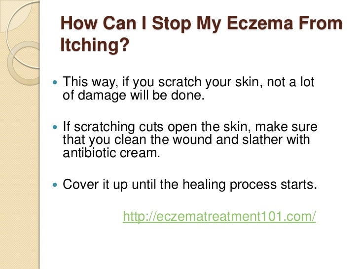 How can i stop my eczema from itching