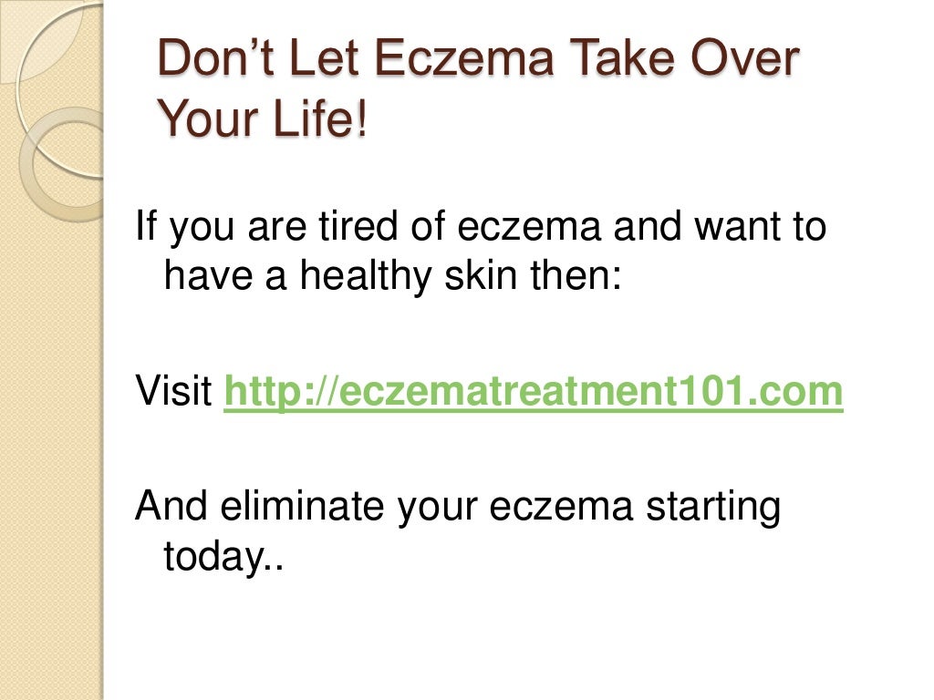 How can i stop my eczema from itching