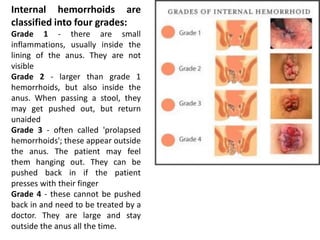 Internal hemorrhoids are
classified into four grades:
Grade 1 - there are small
inflammations, usually inside the
lining of the anus. They are not
visible
Grade 2 - larger than grade 1
hemorrhoids, but also inside the
anus. When passing a stool, they
may get pushed out, but return
unaided
Grade 3 - often called 'prolapsed
hemorrhoids'; these appear outside
the anus. The patient may feel
them hanging out. They can be
pushed back in if the patient
presses with their finger
Grade 4 - these cannot be pushed
back in and need to be treated by a
doctor. They are large and stay
outside the anus all the time.
 
