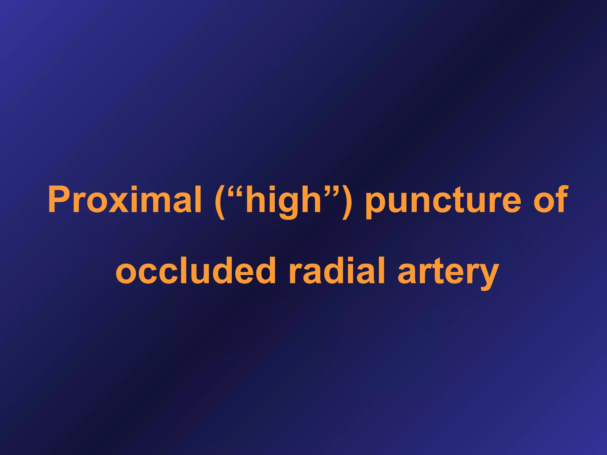 Proximal (“high”) puncture of
occluded radial artery

 