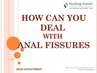 HOW CAN YOU
DEAL
WITH
ANAL FISSURES
https://www.healinghandsclinic.co.in/
Contact: 8888288884BOOK APPOINTMENTBOOK APPOINTMENT
 