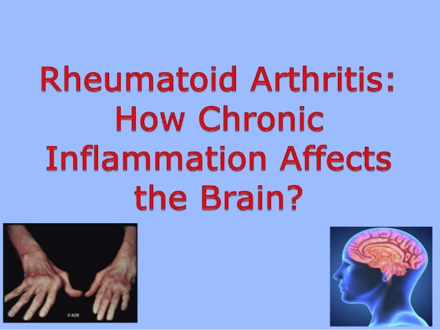 How chronic inflammation in rheumatoid arthritis affects brain pre How chronic inflammation in rheumatoid arthritis affects brain pre