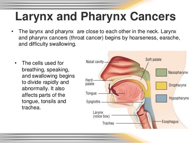 Larynix cancer