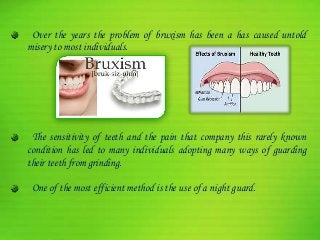 Over the years the problem of bruxism has been a has caused untold
misery to most individuals.
The sensitivity of teeth and the pain that company this rarely known
condition has led to many individuals adopting many ways of guarding
their teeth from grinding.
One of the most efficient method is the use of a night guard.
 