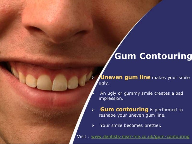 How Cosmetic Dentistry Can Improve Your Smile