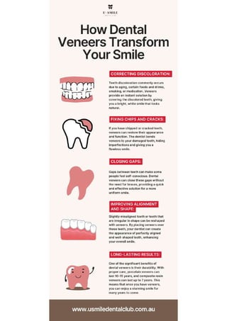 How Dental Veneers can Transform Your Smile | PDF