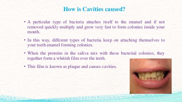 how do cavities form how does plaque form