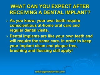 WHAT CAN YOU EXPECT AFTER
RECEIVING A DENTAL IMPLANT?
As you know, your own teeth require
conscientious at-home oral care and
regular dental visits.
 Dental implants are like your own teeth and
will require the same care. In order to keep
your implant clean and plaque-free,
brushing and flossing still apply!


reddinggeneraldentist.com

 