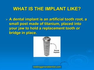 WHAT IS THE IMPLANT LIKE?


A dental implant is an artificial tooth root, a
small post made of titanium, placed into
your jaw to hold a replacement tooth or
bridge in place.

reddinggeneraldentist.com

 