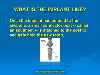 WHAT IS THE IMPLANT LIKE?


Once the implant has bonded to the
jawbone, a small connector post -- called
an abutment -- is attached to the post to
securely hold the new tooth.

reddinggeneraldentist.com

 