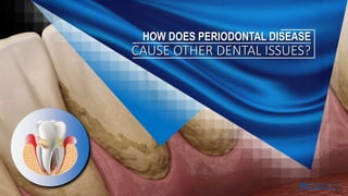 HOW DOES PERIODONTAL DISEASE
CAUSE OTHER DENTAL ISSUES?
 