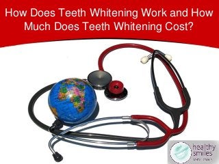How Does Teeth Whitening Work and How
Much Does Teeth Whitening Cost?
 