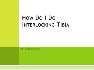 HOW DO I DO
INTERLOCKING TIBIA
 