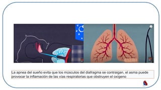 La apnea del sueño evita que los músculos del diafragma se contraigan, el asma puede
provocar la inflamación de las vías respiratorias que obstruyen el oxígeno
 