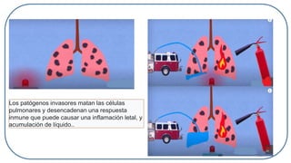 Los patógenos invasores matan las células
pulmonares y desencadenan una respuesta
inmune que puede causar una inflamación letal, y
acumulación de líquido..
 
