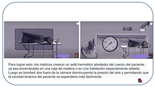 Para lograr esto ,los médicos crearon un sello hermético alrededor del cuerpo del paciente,
ya sea encerrándolo en una caja de madera o en una habitación especialmente sellada.
Luego se bombeó aire fuera de la cámara disminuyendo la presión del aire y permitiendo que
la cavidad torácica del paciente se expandiera más fácilmente.
 