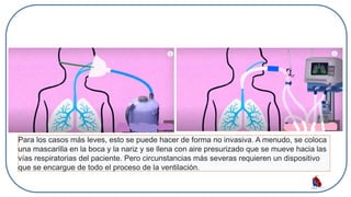 Para los casos más leves, esto se puede hacer de forma no invasiva. A menudo, se coloca
una mascarilla en la boca y la nariz y se llena con aire presurizado que se mueve hacia las
vías respiratorias del paciente. Pero circunstancias más severas requieren un dispositivo
que se encargue de todo el proceso de la ventilación.
 
