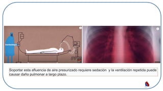 Soportar esta afluencia de aire presurizado requiere sedación y la ventilación repetida puede
causar daño pulmonar a largo plazo.
 