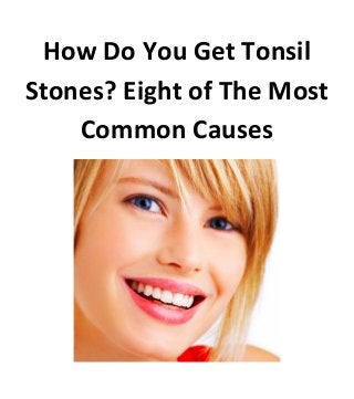 How Do You Get Tonsil
Stones? Eight of The Most
Common Causes
 