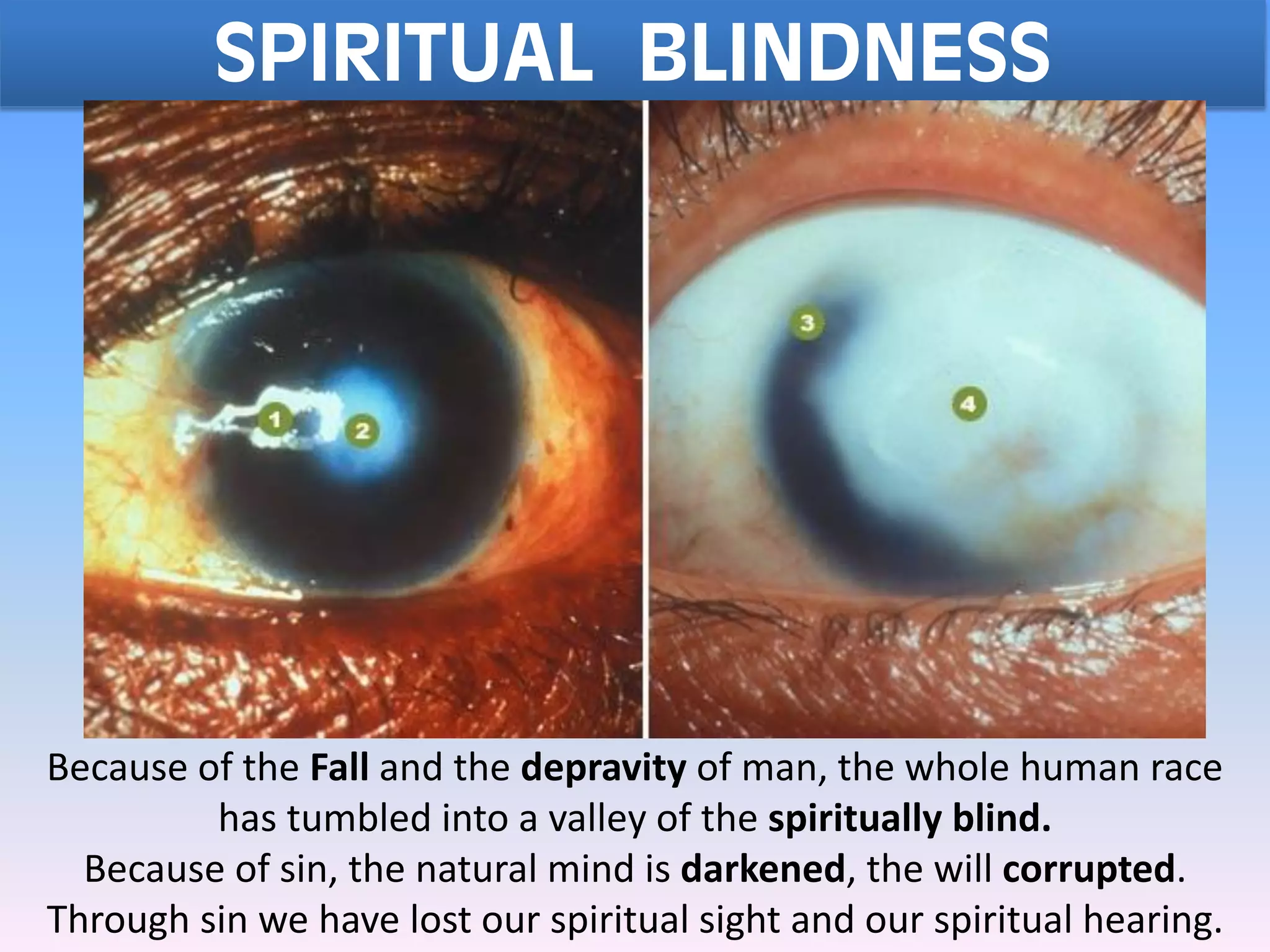 SPIRITUAL BLINDNESS
Because of the Fall and the depravity of man, the whole human race
has tumbled into a valley of the spiritually blind.
Because of sin, the natural mind is darkened, the will corrupted.
Through sin we have lost our spiritual sight and our spiritual hearing.
 