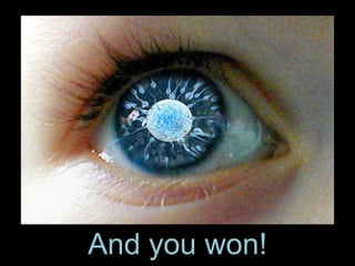 And you won! 